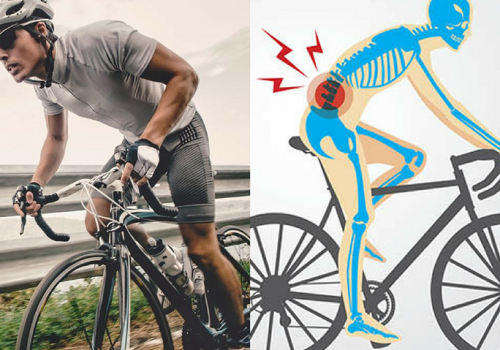 Đau thần kinh tọa có nên đạp xe không?