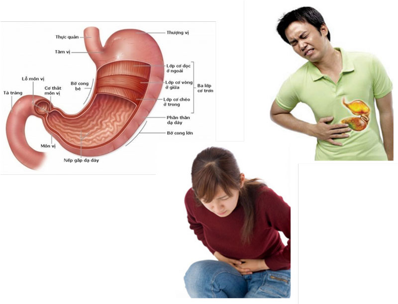 Triệu chứng viêm hang vị dạ dày