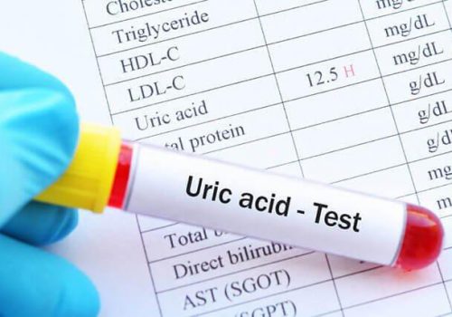 acid uric