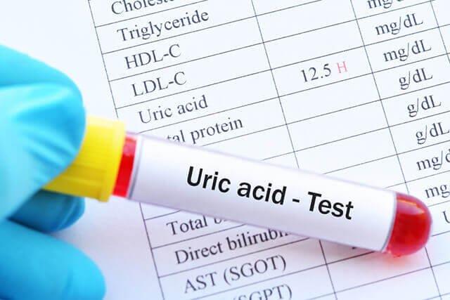 acid uric